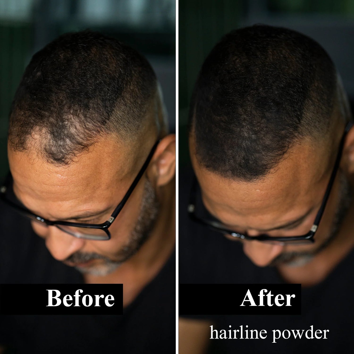 Sevich 12 Color Hairline Powder Hairline Shadow Cover Up Fill In Thinning Hair Unisex Hairline Shadow Powder Modified Gray Hair