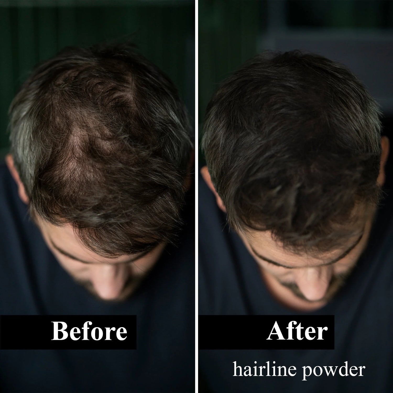 Sevich 12 Color Hairline Powder Hairline Shadow Cover Up Fill In Thinning Hair Unisex Hairline Shadow Powder Modified Gray Hair
